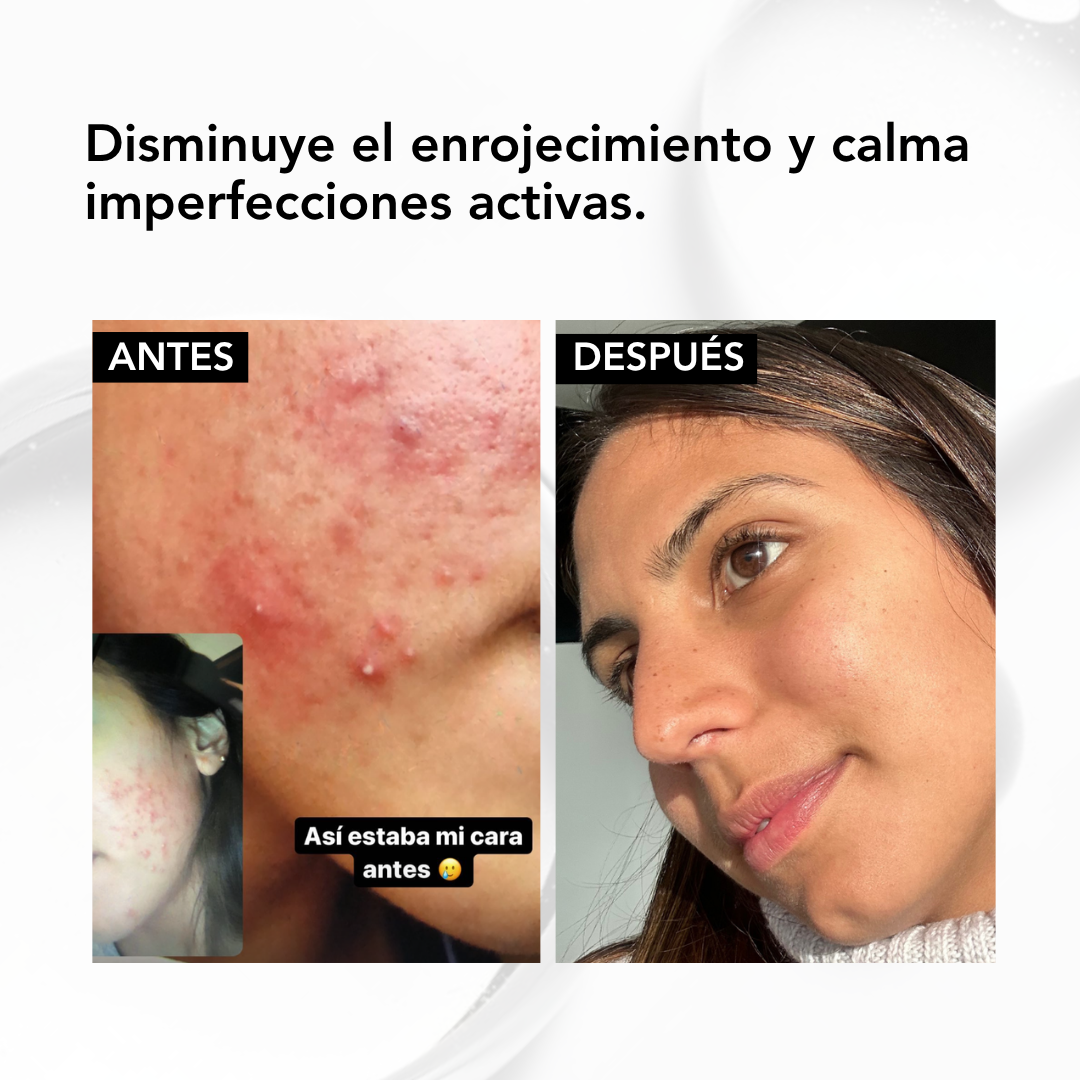 NIACINAMIDE B3 FACIAL SERUM – 30 ml