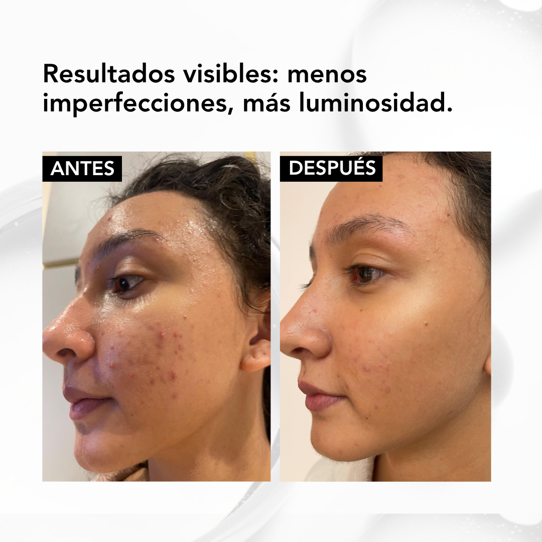 NIACINAMIDE B3 FACIAL SERUM – 30 ml