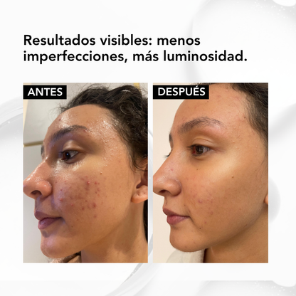 NIACINAMIDE B3 FACIAL SERUM – 30 ml