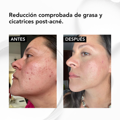 NIACINAMIDE B3 FACIAL SERUM – 30 ml