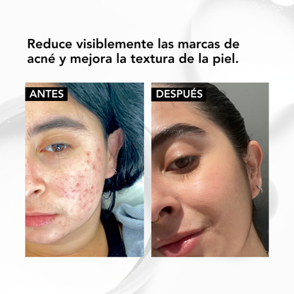 NIACINAMIDE B3 FACIAL SERUM – 30 ml