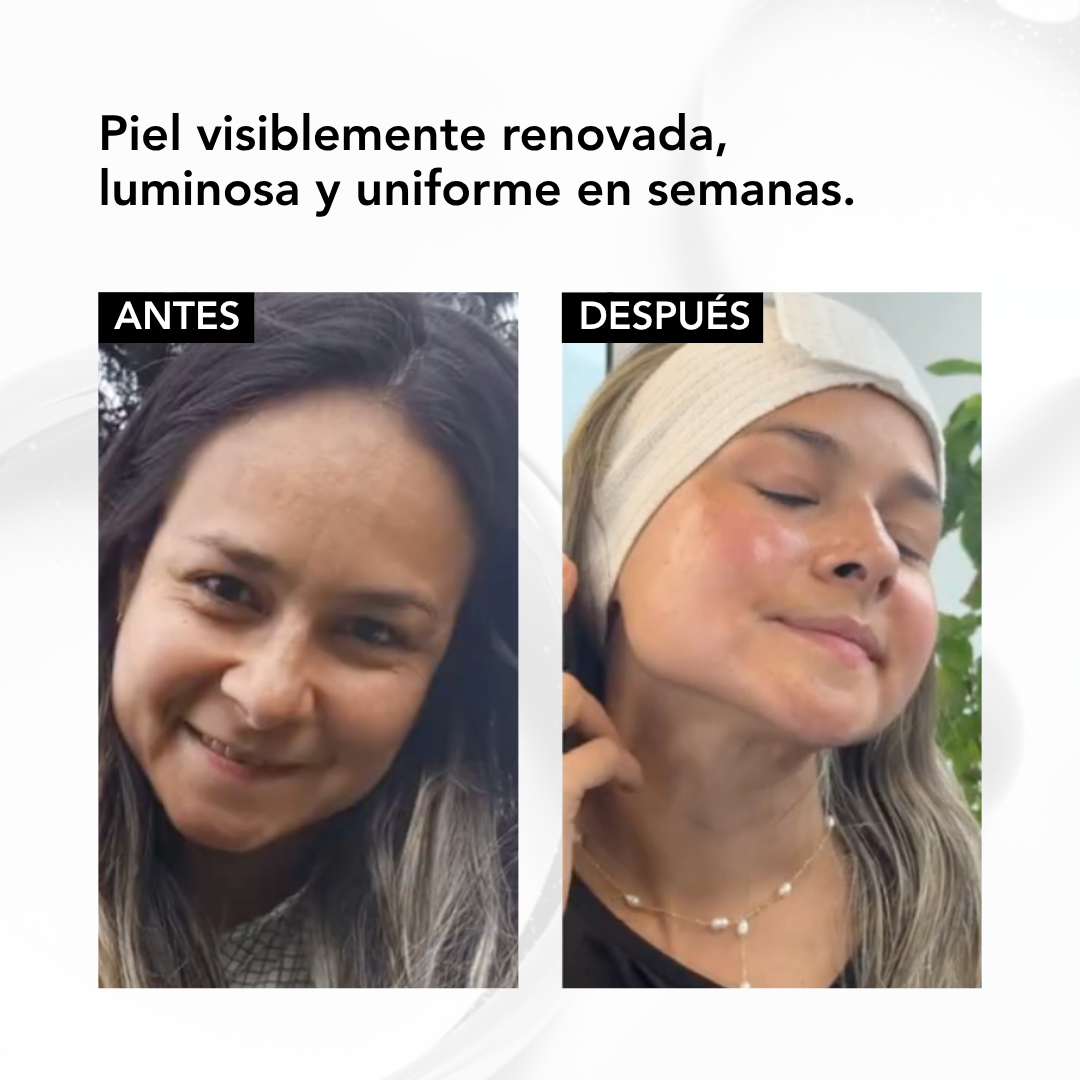 NANORETINOL ENCAPSULADO