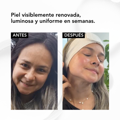 NANORETINOL ENCAPSULADO